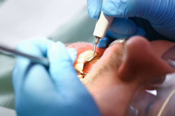 Best Knocked-Out Tooth Emergency  in Tangelo Park, FL