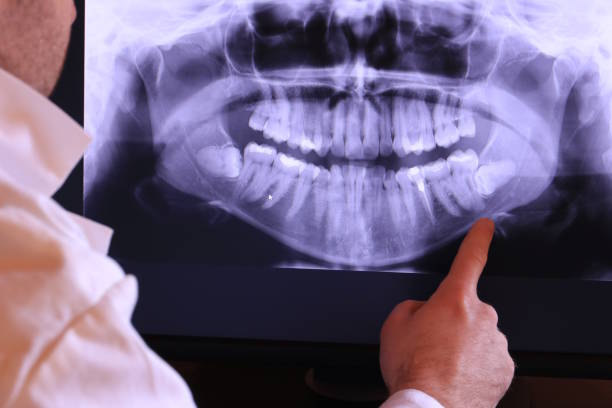 Best Cracked Tooth Emergency Dentist  in Tangelo Park, FL