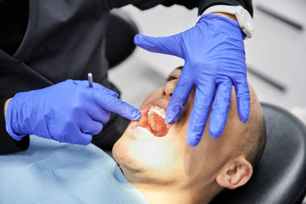 Best Urgent Tooth Repair  in Tangelo Park, FL